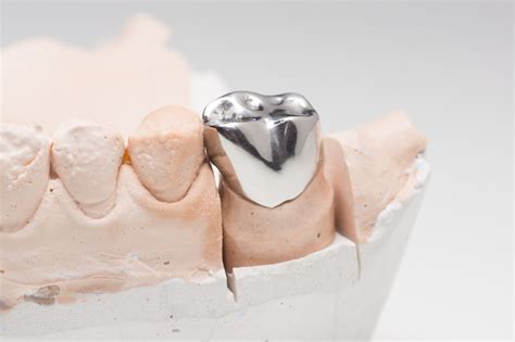 getting metal pre fabricated crown|metal tooth crown cost.